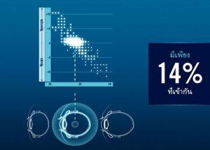 เลนส์โปรเกรสซีฟ-B.I.G. vision-ความยาวกระบอกตา